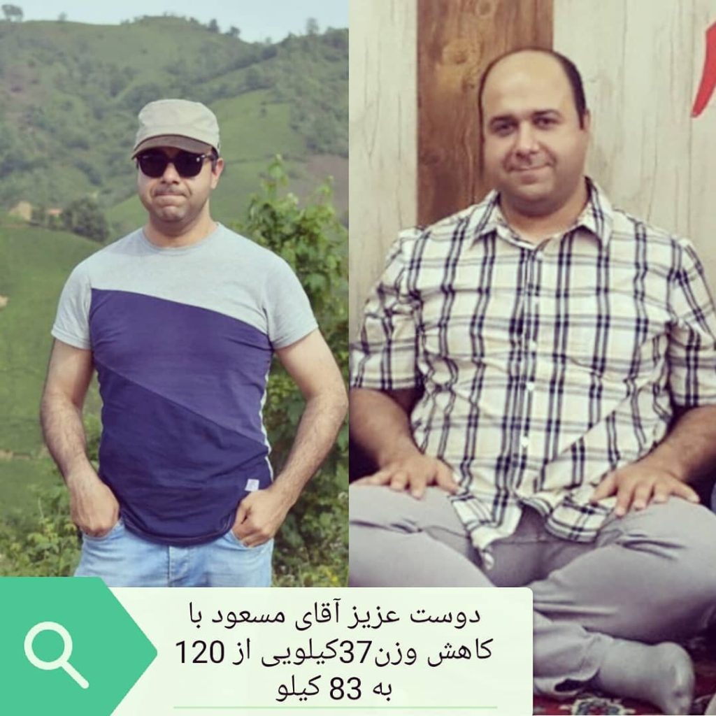 لاغری