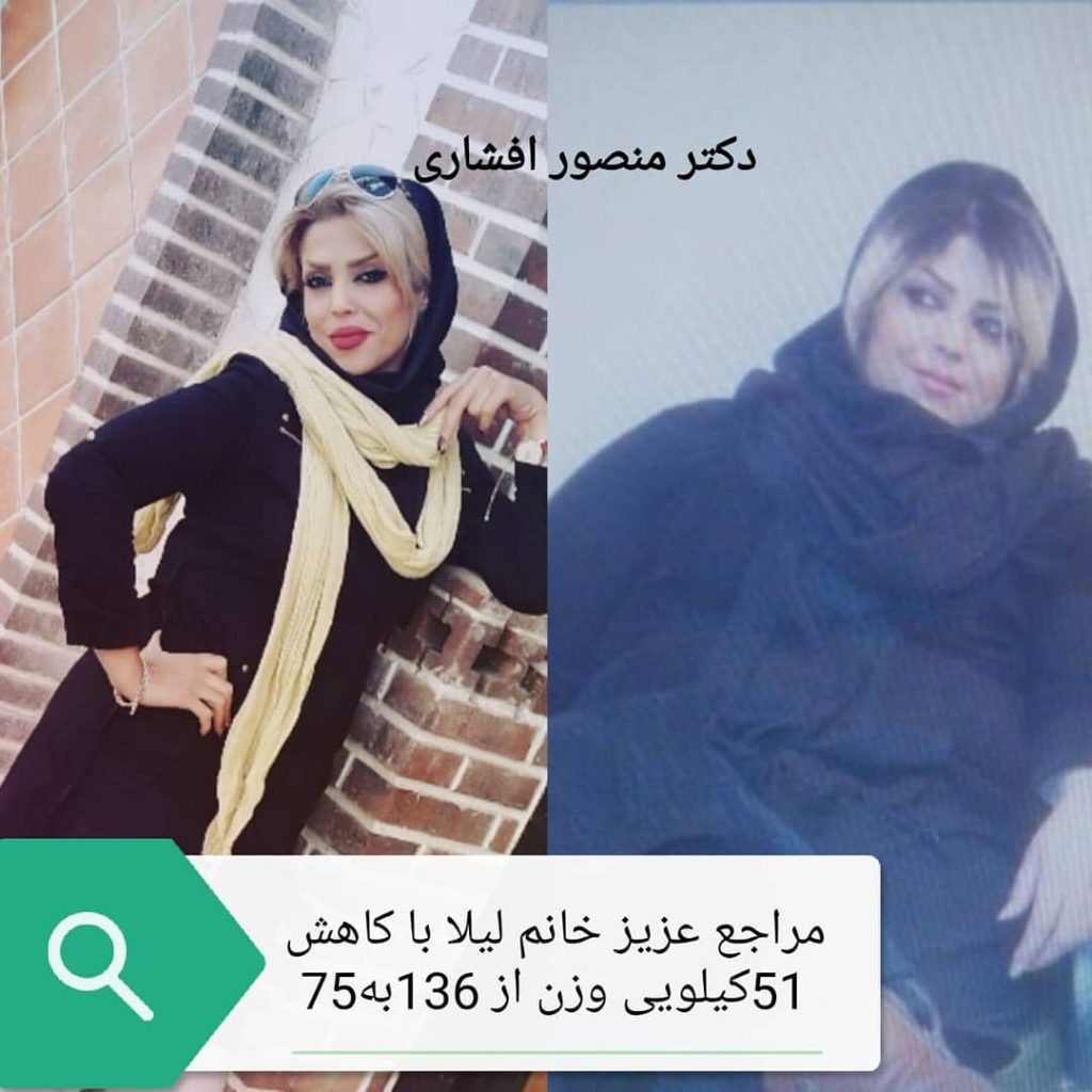 لاغری و کاهش وزن