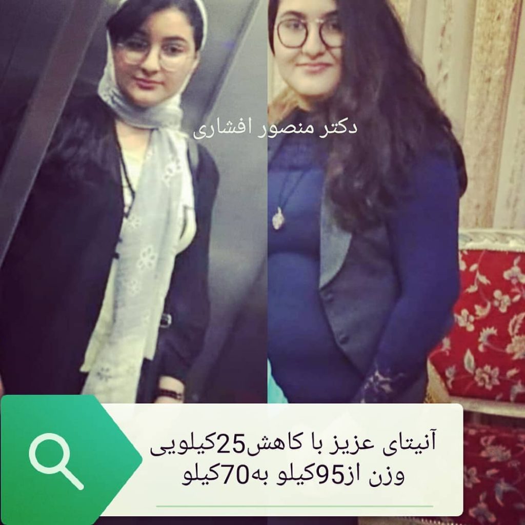 کاهش وزن